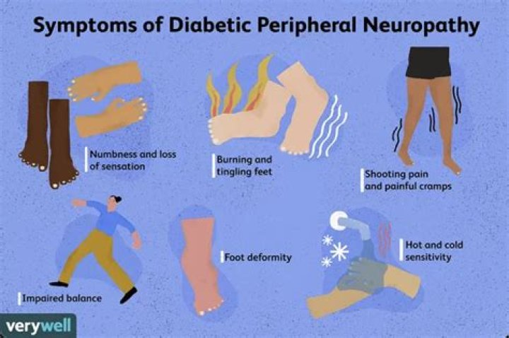 What does neuropathy feel like in your legs and feet?