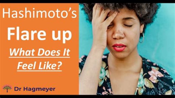 What does RA flare feel like?