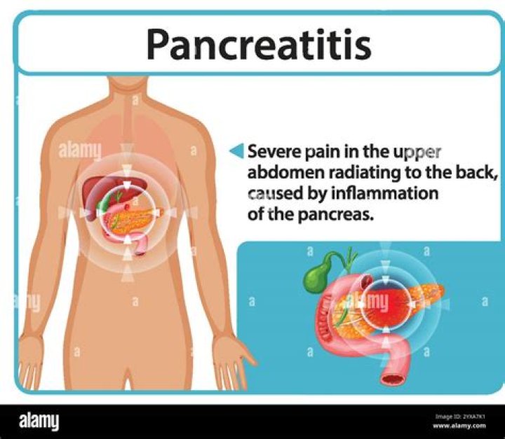 What does the pain from pancreatitis feel like?