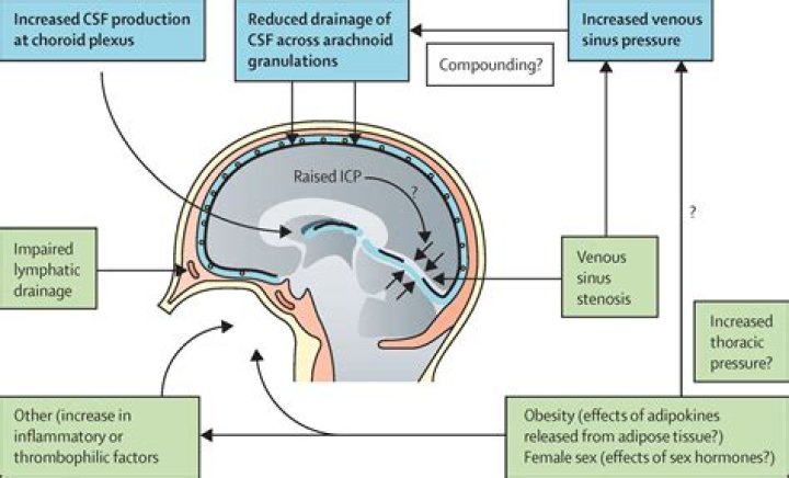 What drugs reduce intracranial pressure?