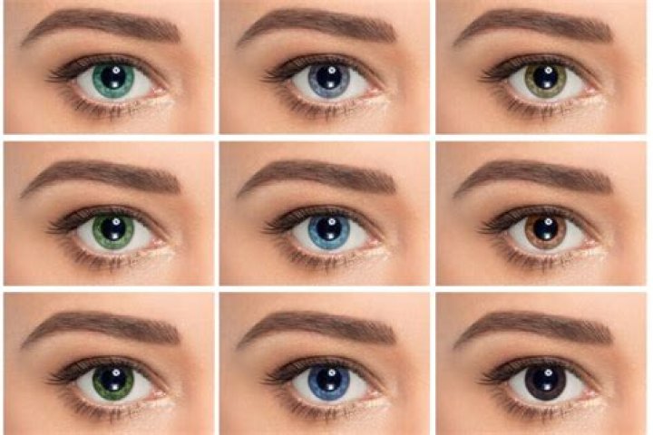 What eye color is most common?