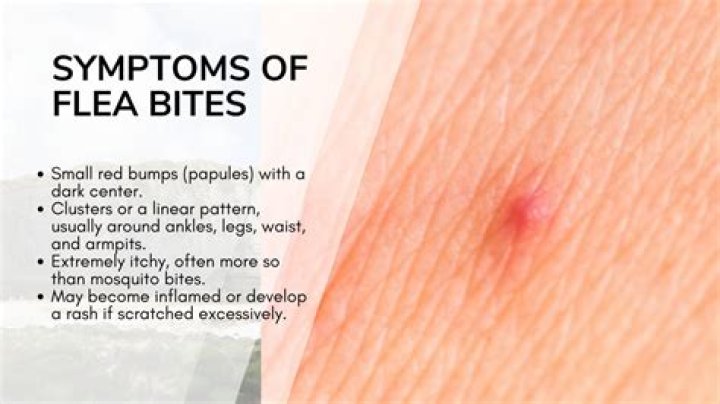 What flea bites look like?