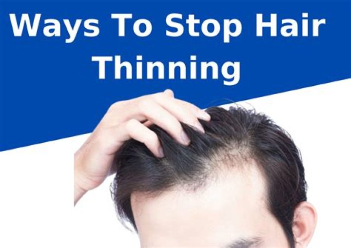 What foods stop hair thinning?
