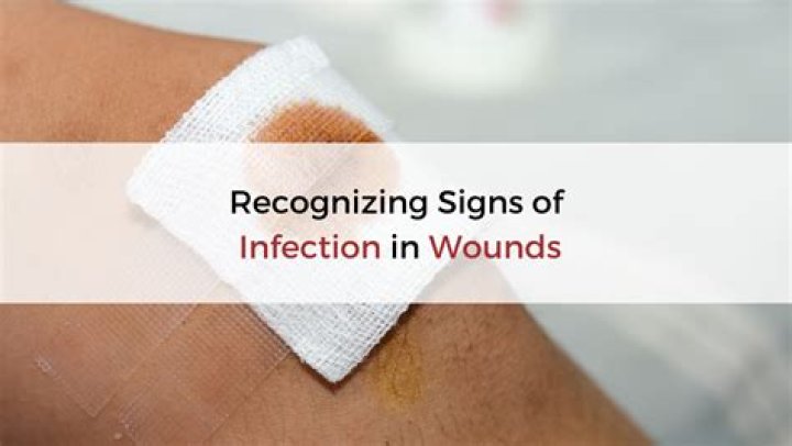 What happens if a wound is infected for too long?