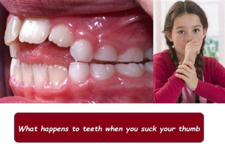 What happens if I use too much data?