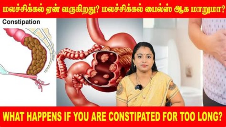 What happens if you are constipated for too long?