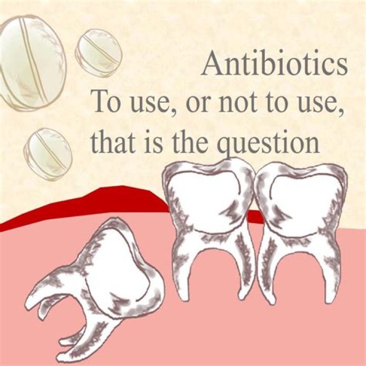 What happens if you don't take antibiotics after tooth extraction?