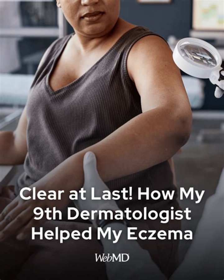 What helped my eczema?