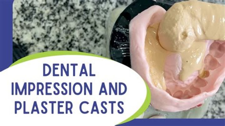 What is a dental plaster?