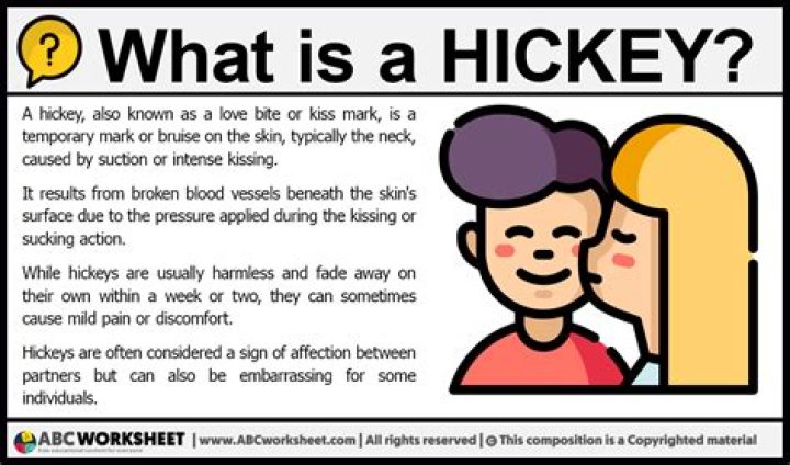 What is a hickey?