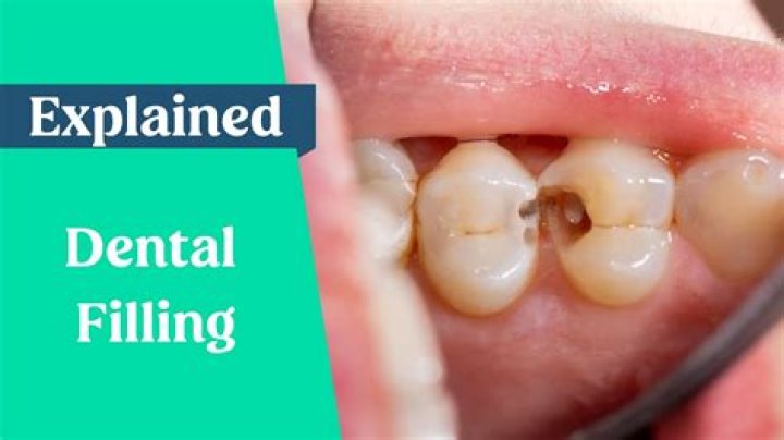 What is a white filling called?