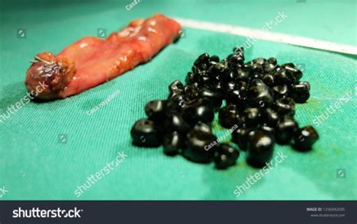 What is black kidney?