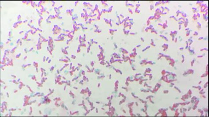 What is blue pus bacillus?