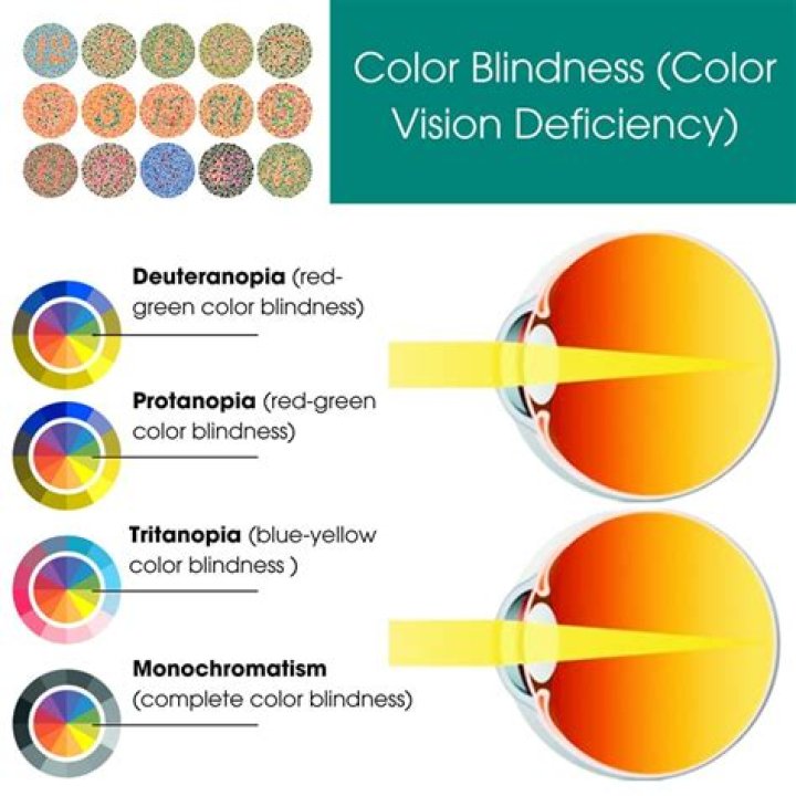 What is called color blindness?