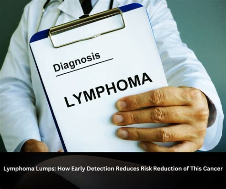 What is considered early detection of lymphoma?