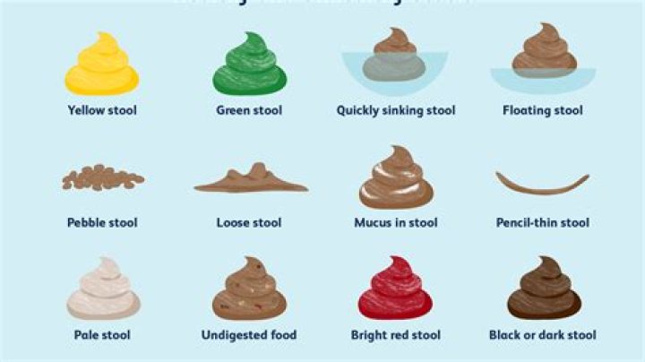 What is considered light colored stool?