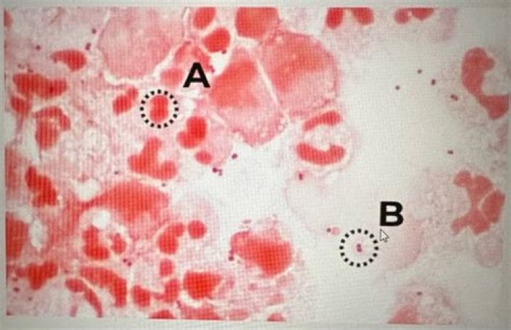 What is counterstain in microbiology?