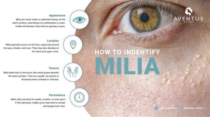 What is inside milia?