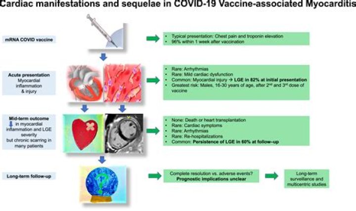 What is known about the COVID-19 vaccine related myocarditis in people younger than 21?