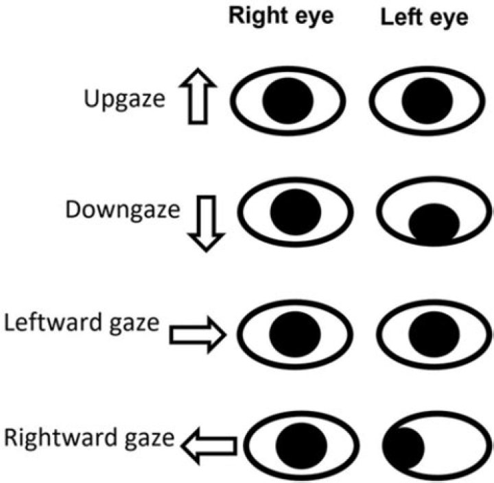 What is left gaze preference?