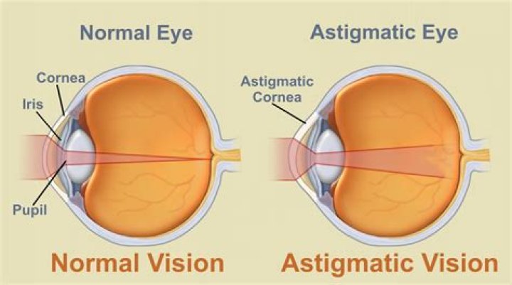 What is regular astigmatism?