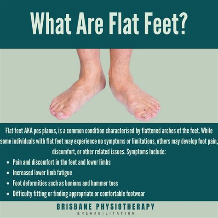 What is the downside of having flat feet?