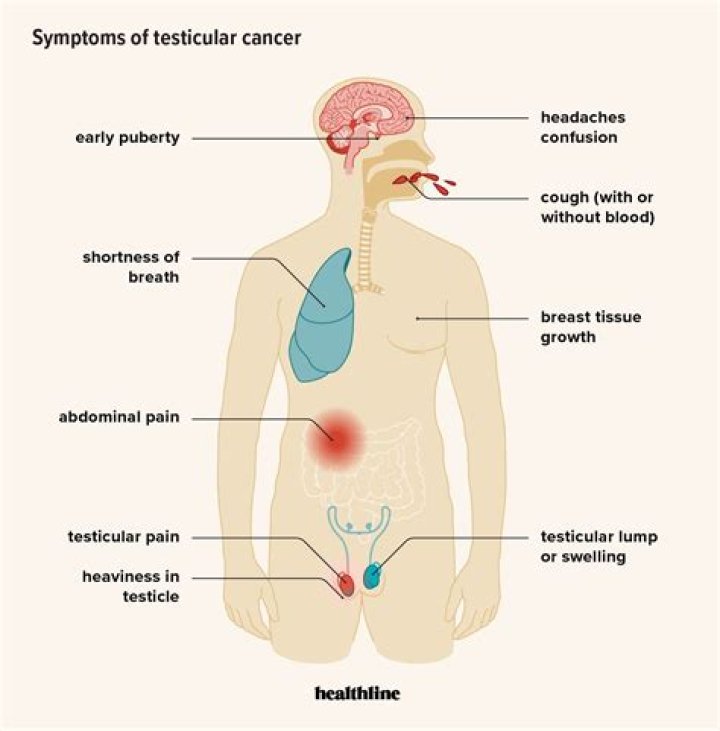 What is the most common cause of a swollen testicle?
