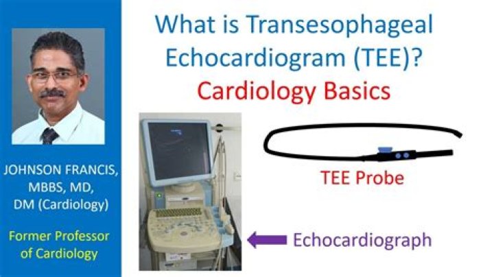What is the prep for echocardiogram?