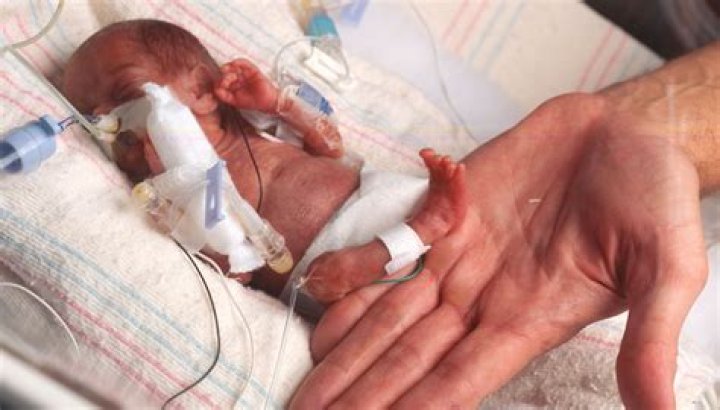 What is the smallest baby ever born?