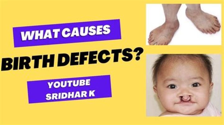 What is the weirdest birth defect?