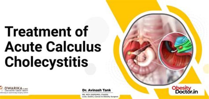 What is treatment of acute cholecystitis?
