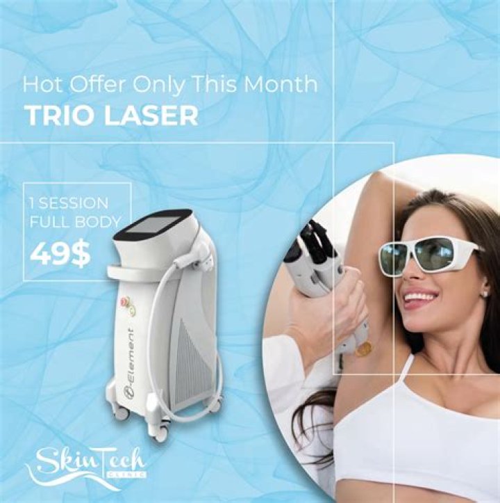 What is trio laser?