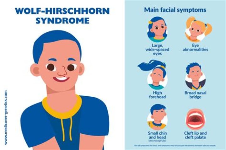 What is Wolf Hirschhorn Syndrome?