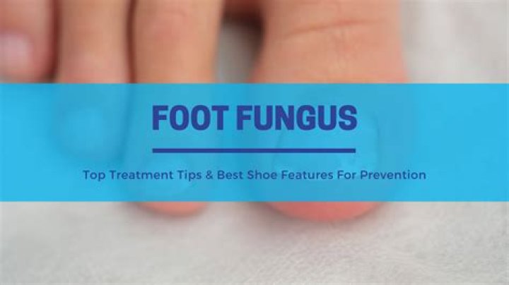 What kills shoe fungus?