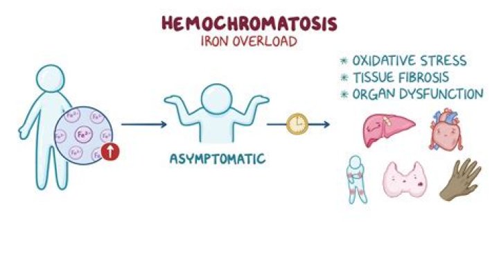 What labs are elevated in hemochromatosis?