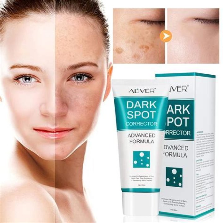 What lightens dark spots?