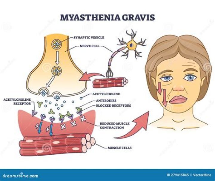 What mimics myasthenia gravis?