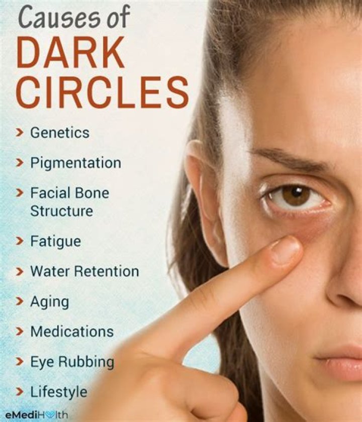 What organ causes dark circles?