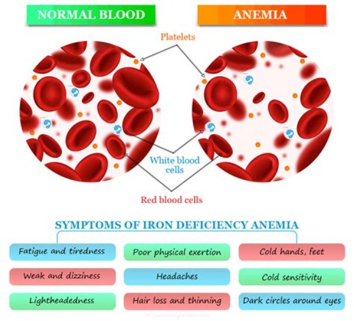 What organ is affected by anemia?