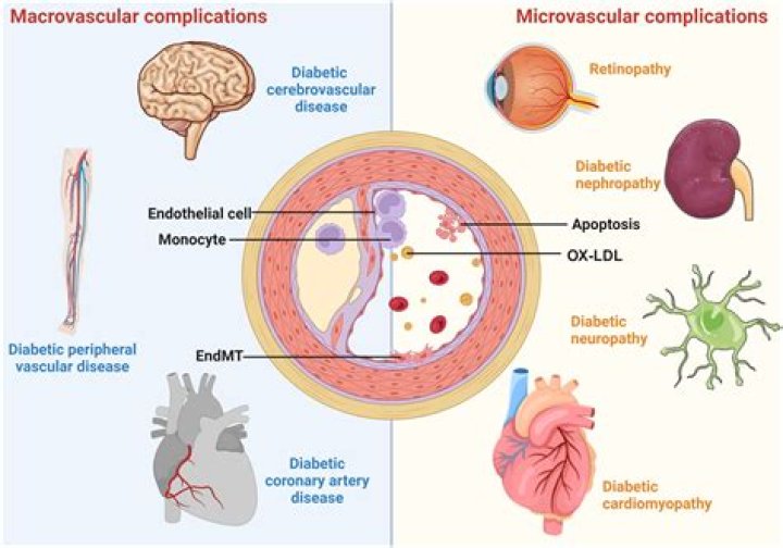 What parts of the body are affected by microvascular complications?