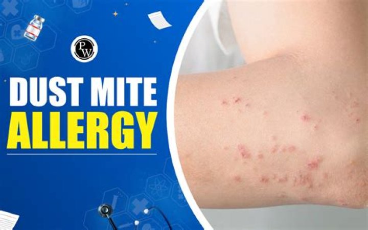 What symptoms do dust mites cause?