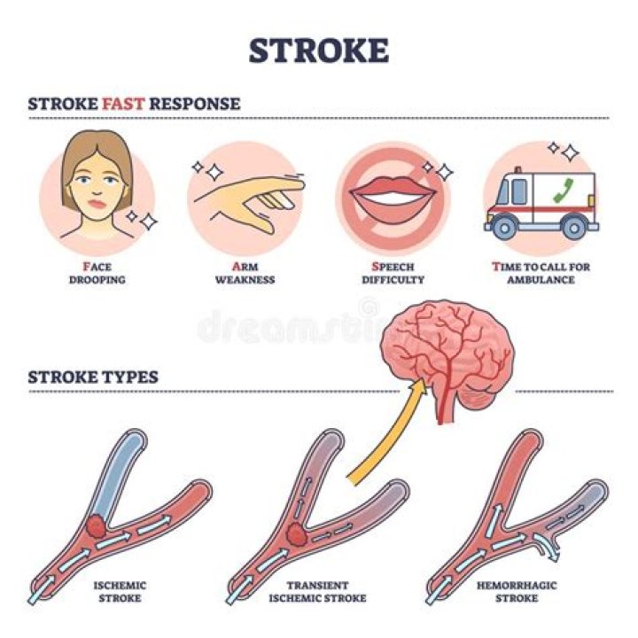 What time of the day do most strokes happen?