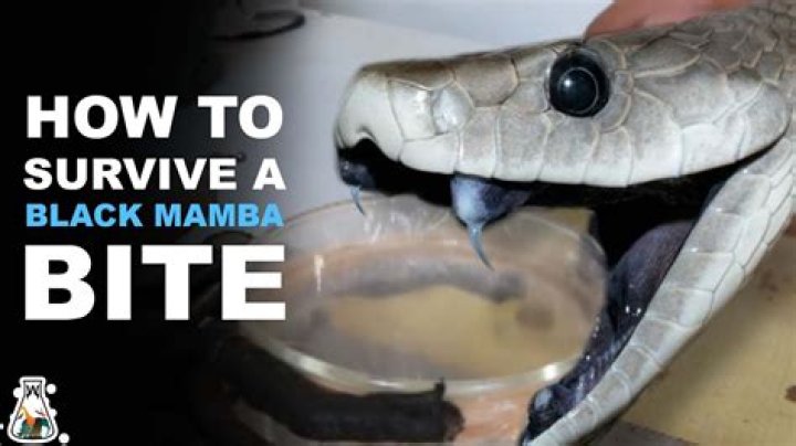 What to do if a black mamba bites you?