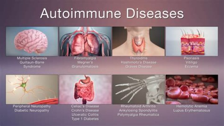 What triggers the start of autoimmune diseases?