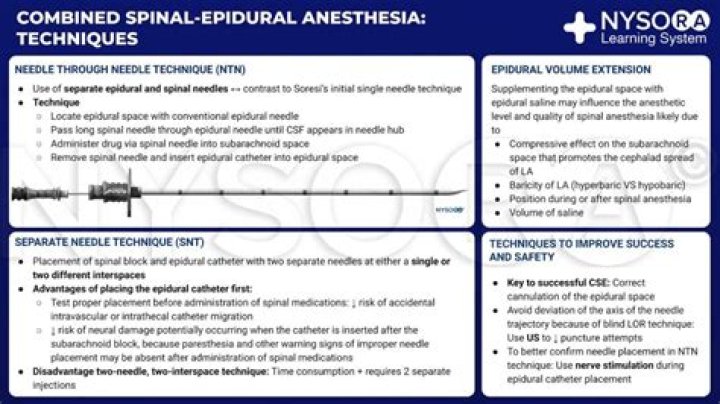What type of anesthesia is used for endoscopy?