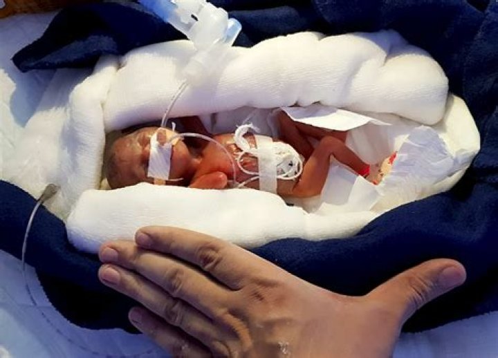 What was the smallest baby born?