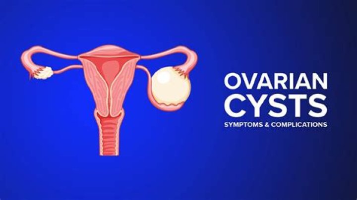 When should I be concerned about ovary pain?