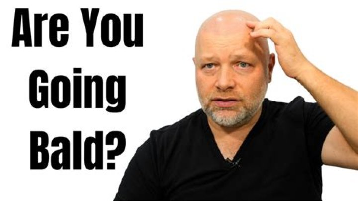When should you go bald?