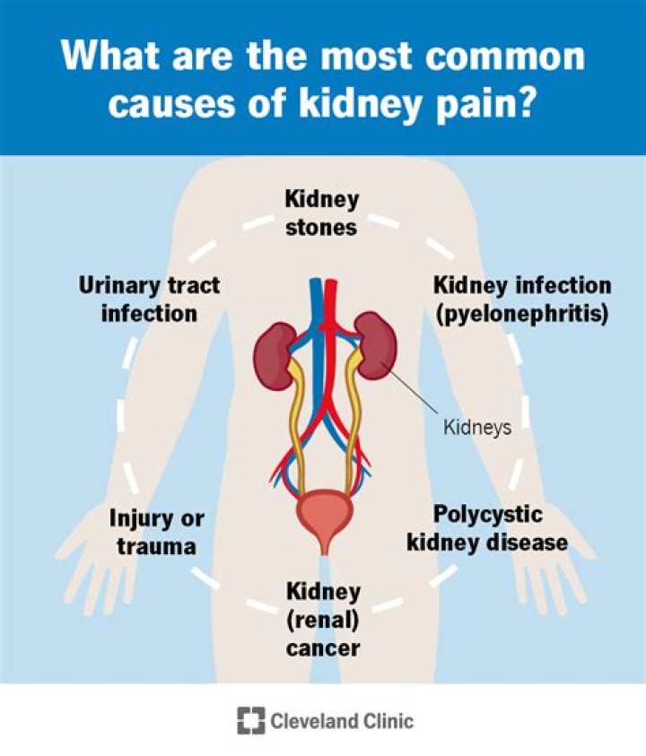 Where do kidneys hurt?