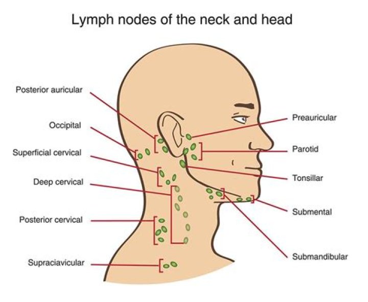 Where do lymphoma lumps appear?